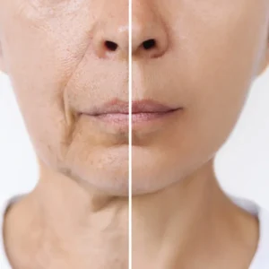 Before and after comparison showing dry aging skin transformed into smoother nourished complexion — results of using the best body lotion for dry aging skin