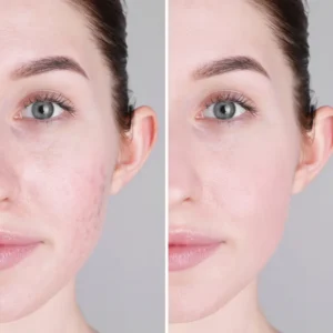 Before and after results showing skin brightening and improved facial skin tone.