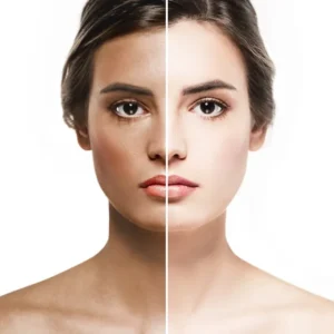 Before and after split view highlighting facial skin brightening and dark spot reduction using a Korean beauty face serum.