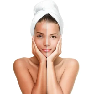Before and after split photo showing dry dull skin vs hydrated smooth skin results using the best body shower gel for dry skin